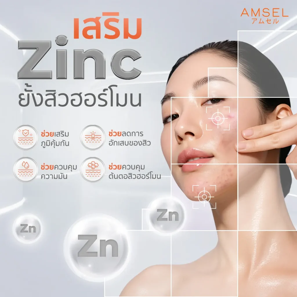เสริม Zinc ยั้งสิวฮอร์โมน